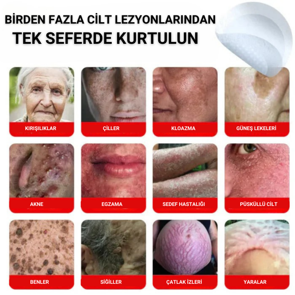 Ryles Mikro İğneli Ben Bandı 5 Günde Acısız Son!