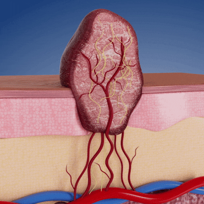 Ryles Mikro İğneli Ben Düşürücü Bant – 5 Günde İz Bırakmadan Düşürür